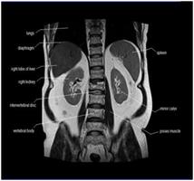 MRI of the Abdomen2 MRI of the Abdomen2